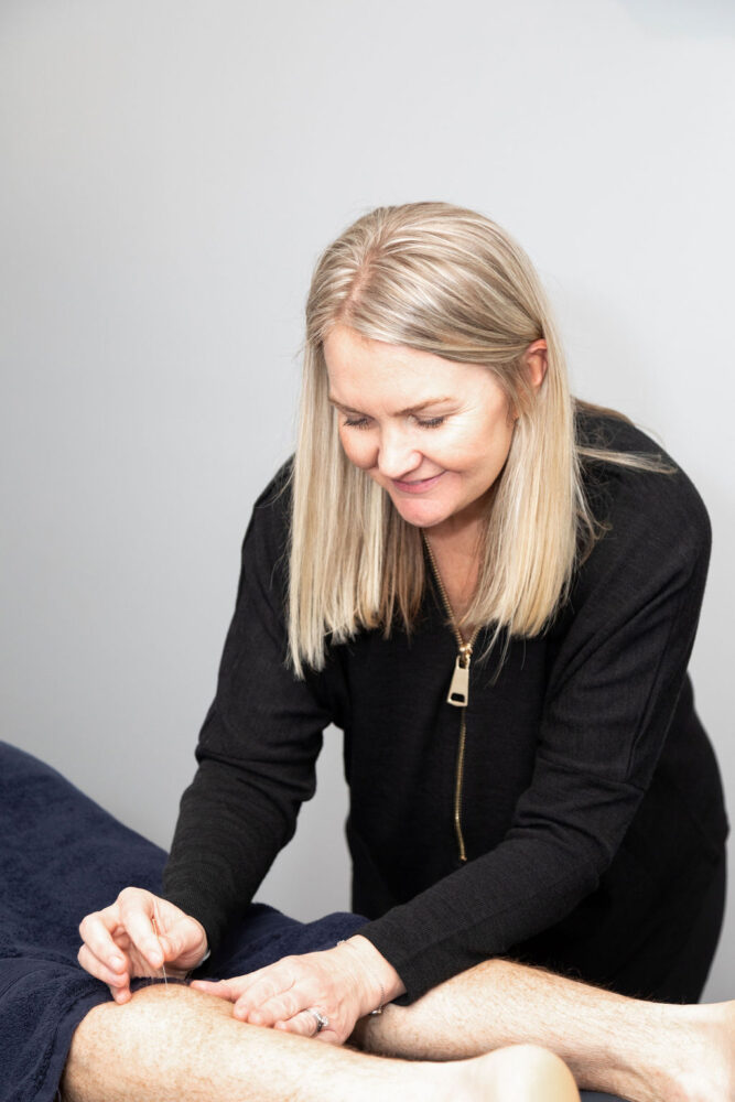 Dry Needling Pakenham Dry Needling Pakenham