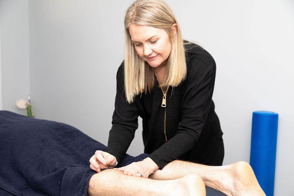 Dry needling Berwick Dry needling Berwick